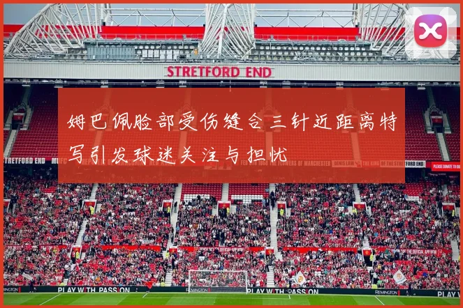 姆巴佩脸部受伤缝合三针近距离特写引发球迷关注与担忧